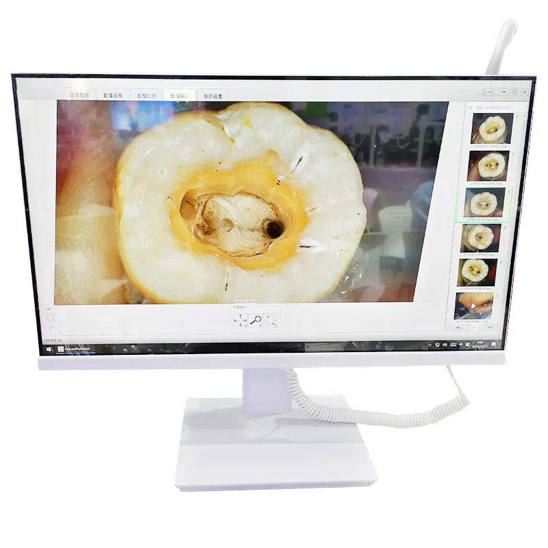 Cámara intraoral dental, endoscopio USB, cámara de vídeo intraoral, cámara intraoral inalámbrica, cámara dental intraoral