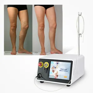 2023 Hot Sale Diode Laser 980nm 1470nm Evla Varicose Veins Treatment Machine