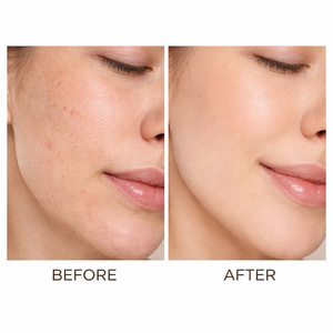 Crema rejuvenecedora avanzada que suaviza la piel, ilumina el cutis, hidrata y mantiene la elasticidad de la piel. - Product Image 3