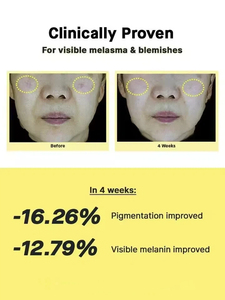 Etrun Alisa เซรั่มบำรุงผิวหน้า Niacianmide แบรนด์ส่วนตัวทำให้ผิวเรียบเนียนกระจ่างใสไร้ริ้วรอยเล็กๆเซรั่มจุดด่างดำ - Product Image 3