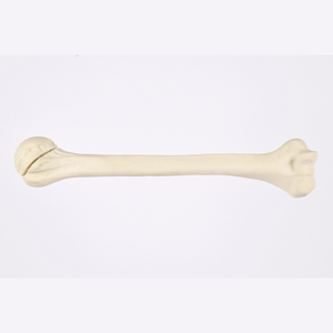 Kyrenmed cortical humerus ขวา fractureed กับ proximal humerus fracture สำหรับการประชุมเชิงปฏิบัติการการตัดเจาะ - Product Image 2