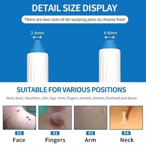 Convenient Manual Operation Treatment Micro Skin Tag Removal Device Skin Tag <strong>Remover</strong> <strong>Wart</strong> <strong>Remover</strong> Acne Pimple - Product Image 6