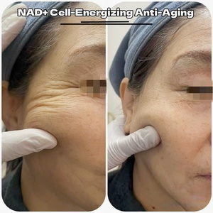 <span class=keywords><strong>Ampoules</strong></span> de poudre lyophilisée NAD+ Peptide anti-âge NAD Plus Peptide 100mg PDRN & NAD+ Peptide prêtes à être expédiées – Soin booster cutané - Product Image 3