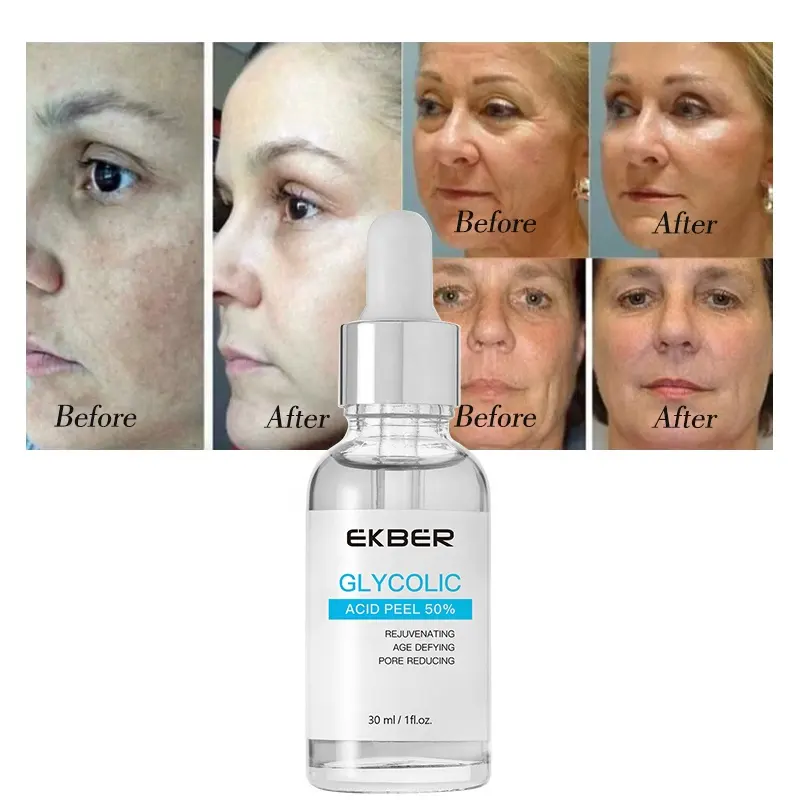 Logo personnalisé Offre Spéciale sérum de soins de la peau acide chimique peeling pour le visage acné et cicatrices 50% acide glycolique sérum peeling vente en gros