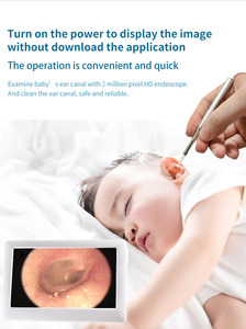 أدوات تنظيف الأذن ، شاشة Lcd بشاشة ذكية لإزالة شمع الأذن ، منظار الأذن بكاميرا فيديو بصرية - Product Image 5