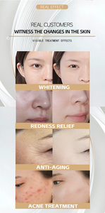 Dispositivo Portátil ABS de Ultrasonido Antienvejecimiento de 3MHz y 10MHz para Reducir Poros y Lifting Facial, para Uso en Salón de Belleza y en Casa - Product Image 3