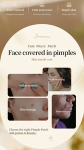 Plester Jerawat Hidrokoloid Motif Bintang Cinta Bulat Warna Kustom Label Pribadi untuk Remaja - Product Image 4