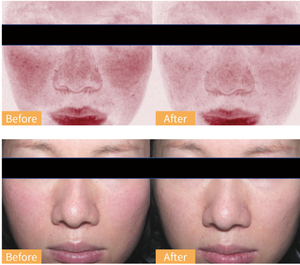 Suero Facial Personalizado con Proteína Adhesiva de Mucina de Mejillón Liofilizada, Repara la Piel Sensible con Acné, Marca Privada OEM - Product Image 3