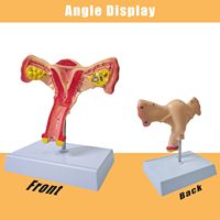 Modelo Anatómico Realista de Órganos Femeninos a Tamaño Real, Útero y Ovario, para la Enseñanza de Ciencias Médicas
