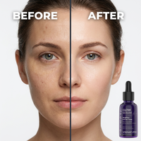 Sérum Éclaircissant au Glutathion AGE-R Marque Blanche – Éclat, Unification du Teint, Anti-Oxydation, Anti-Glycation – Sérum Visage au Glutathion OEM