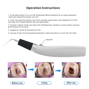 Endo Ultra Activator Dentale Draadloze Endodontische Wortelkanaalirrigator Chirurgie Endo Wasmachine Tandheelkundig Instrument Draadloos - Product Image 2