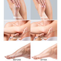 Sérum éclaircissant rapide Calantha Dark Knuckles, hydratant, correcteur de pigmentation pour peaux noires, mains, coudes, genoux, intense