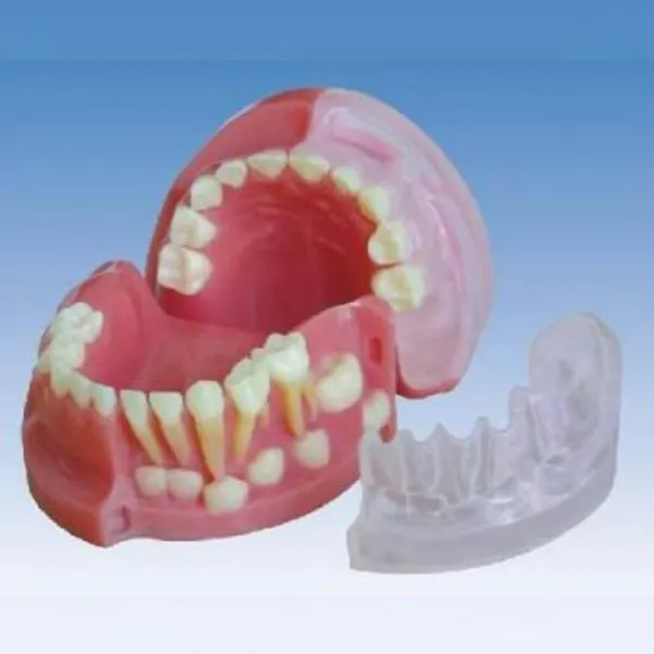 BIX-L1021 Children's tooth model three-year-old deciduous permanent tooth alternating anatomical model