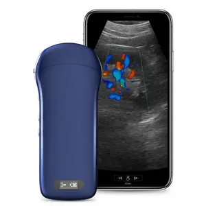 China New Hot-sale Portable Medical Diagnosis Ultrasound device Wireless Ultrasound Machine in good price