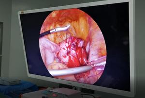 Système de caméra d'endoscopie médicale Full HD, système de caméra d'endoscopie 4K, tour laparoscopique 4K - Product Image 2