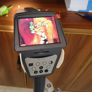 Yeni geliştirilmiş maliyet etkin C6HD vajinal kolposkopi jinekolojik hastalık teşhis aracı klinik için - Product Image 5