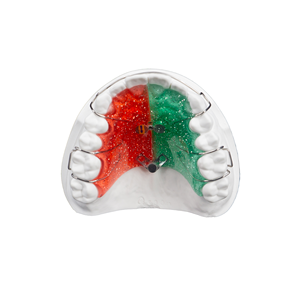 <span class=keywords><strong>Appareil</strong></span> orthodontique amovible Hawley en acrylique pour la rétention post-traitement et la personnalisation - Product Image 6