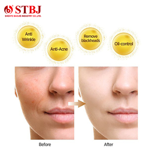 DR.DAVEY Mascarilla facial Marula Oil Peel-off Mascarilla facial <span class=keywords><strong>Blackhole</strong></span> Remover - Product Image 2
