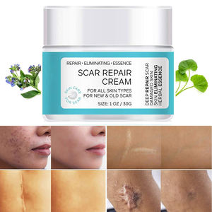 <span class=keywords><strong>Crema</strong></span> Hidratante Antienvejecimiento de Marca Privada <span class=keywords><strong>para</strong></span> Cicatrices Oscuras, Estrías, Acné, Eliminación de la Pigmentación, <span class=keywords><strong>Crema</strong></span> Facial Iluminadora <span class=keywords><strong>para</strong></span> el Cuidado de la Piel <span class=keywords><strong>para</strong></span> Personas Mayores - Product Image 6