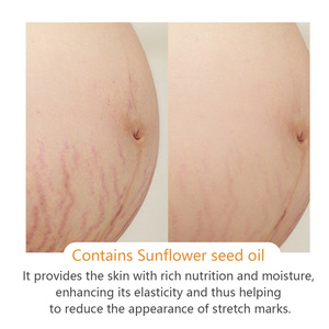 Crème pour les vergetures de <span class=keywords><strong>grossesse</strong></span> au palmitoyl tripeptide-5, peptide pour resserrer la peau affaissée, crème pour les vergetures des jambes - Product Image 4