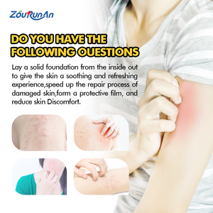 Zourunan 60ml ong 2025 nọc độc chống ngứa phun cho da phun nhắm mục tiêu eczema bệnh vẩy nến bong tróc sưng ngứa - Product Image 3