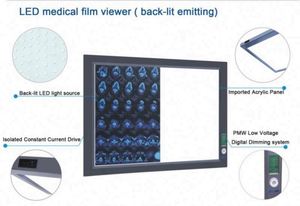 Y tế LED duy nhất đôi X-Ray phim xem Illuminator ánh sáng người xem - Product Image 3