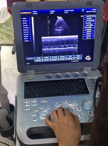 Appareil d'échographie vétérinaire 3D, échographie cardiaque médicale portable de 15 pouces - Product Image 4