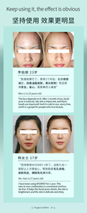 Nueva máquina portátil de dermoabrasión facial Aqua 8 en 1 con oxígeno para lifting facial y cuidado de la piel. - Product Image 2