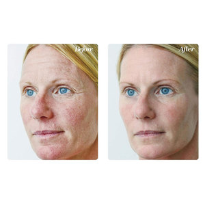 Crema Facial Hidratante y Reparadora con Péptidos de Cobre Azul, Productos Orgánicos Veganos para el Cuidado Facial con Extracto de <span class=keywords><strong>Aloe</strong></span> y Suculentas, ODM/OEM - Product Image 3
