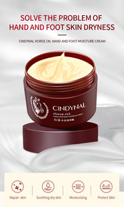 Venta al por mayor <span class=keywords><strong>crema</strong></span> hidratante antigrietas de pies seca reparación <span class=keywords><strong>Urea</strong></span> aceite de caballo manos pies <span class=keywords><strong>Crema</strong></span> <span class=keywords><strong>para</strong></span> el cuidado de los pies paquete personalizado <span class=keywords><strong>crema</strong></span> de maíz de los dedos del pie - Product Image 4