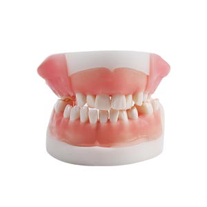 Modello di Pratica per Cisti Dentali per <span class=keywords><strong>Formazione</strong></span> Chirurgica Orale Prodotto per Scienze Mediche - Product Image 1