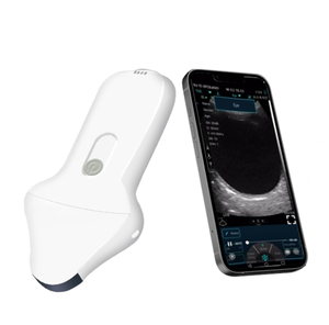 Appareil d'échographie médicale portable de poche sans fil avec sonde micro-convexe couleur USB+WIFI sans fil pour les yeux - Product Image 3