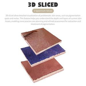 Analyseur de peau intelligent à IA, appareil de diagnostic facial, test d'hydratation du visage, analyse faciale, appareil d'analyse de la peau 3D - Product Image 2