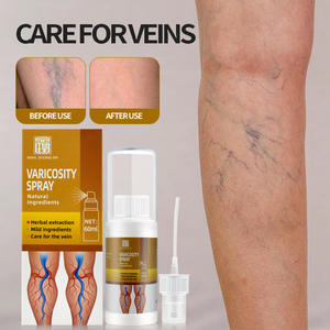 Pasokan Perawatan Kesehatan Lintas Batas untuk Meredakan Varises dari Pembuluh Darah yang Menonjol, Nyeri, Mati Rasa, dan Pembengkakan di Kaki - Product Image 2
