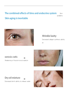 Aston astrodome mặt máy trị liệu Oxy da chuyên nghiệp hydrat hóa & trẻ hóa thiết bị cho salon - Product Image 4