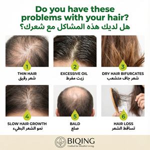 Barra de Champú Anticaída con Jengibre, Jabón Calmante para el Cuero Cabelludo con Artemisia, Barra Limpiadora Capilar Natural con Bayas de Jabón para Reparación del Cabello Fino - Product Image 2