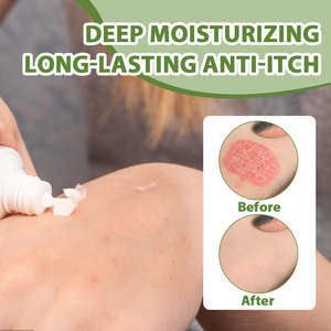 Krim teh eksim, salep antibakteri Dermatitis <span class=keywords><strong>Psoriasis</strong></span>, plester medis pijat Anti gatal kulit - Product Image 5