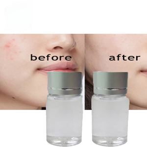 Suministro de fábrica Precio de ácido glicólico ordinario Grado cosmético industrial 20% 70% Ácido glicólico - Product Image 1