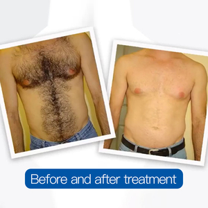 2025 phổ biến nhất D19 trẻ hóa da Thiết bị vẻ đẹp máy - Product Image 5