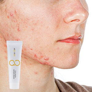 Produk Perawatan Kulit Pemulihan Kerusakan Fotoelektrik Meredakan Sensasi Rasa Tergigit Krim Kolagen Kelas Medis - Product Image 5