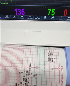 Monitor Portátil de Frecuencia Cardíaca Fetal Individual, Máquina <span class=keywords><strong>CTG</strong></span> con Pantalla LCD Clara para Cuidado Prenatal - Product Image 2