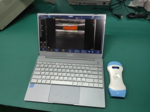 Escáner de Ultrasonido Doppler a Color 3 en 1 Inalámbrico, de Bajo Costo y Tamaño Compacto, Equipo Médico para Hospital - Product Image 3
