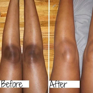 โลชั่นบำรุงผิวกายสูตรเข้มข้น ผสมโคจิก แอซิด ช่วยให้ผิวขาวกระจ่างใส ลดรอยดำบริเวณข้อศอก หัวเข่า ข้อพับนิ้วมือ ไม่มีน้ำหอม - Product Image 2