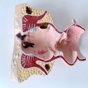 Menselijk Colorectaal Model Rectaal Pathologisch Aambei Model Anale Fistel Anatomisch Model - Product Image 6