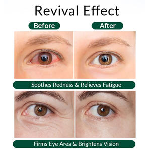 Appareil de hydratation des yeux rechargeable électrique à pulvérisation de vitamine B12, apaisant pour les paupières, fournisseur en vogue - Product Image 6