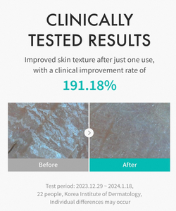 REJURAN ®   Tónico Hidratante con c-PDRN ®   Tónico Facial Hidratante para Mejorar la Resistencia de la Barrera Cutánea - Product Image 6