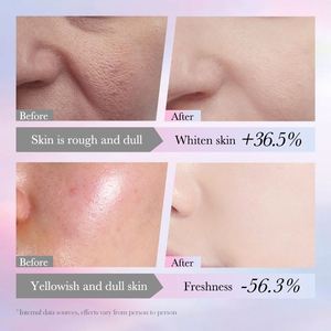 Loción Facial SADOER de Marca Privada, Orgánica, con Niacinamida, Blanqueadora, Reparadora de Manchas, Nutritiva y Reafirmante para el Cuidado de la Piel - Product Image 4