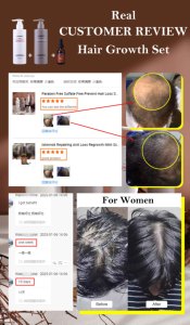 Istennok Biotina, Aceite para el Crecimiento del Cabello con Jengibre, Aceite de Romero a Base de Plantas, Suero para el Crecimiento del Cabello - Product Image 5