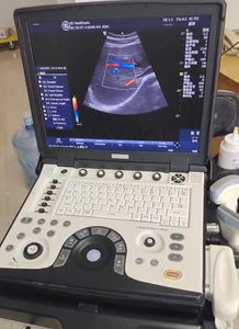 Máquina de ultrasonido LOGIQ E de suministro precio competitivo, Envío Mundial - Product Image 4