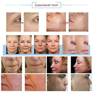 New <strong>Morfeus</strong> 8 Microneedle Radiofrequenz Microneedling Rf Lifting Needle Portati Facial and Body Tightening Machine - Product Image 5